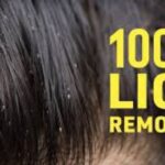 Getting Rid of Lice: Effective Strategies for a Lice-Free Life