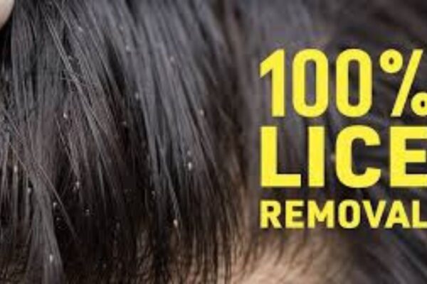 Getting Rid of Lice: Effective Strategies for a Lice-Free Life