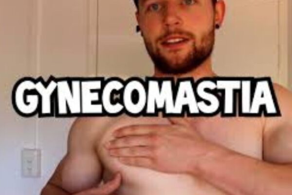 Celebs with Gynecomastia: Shedding Light on a Common Condition