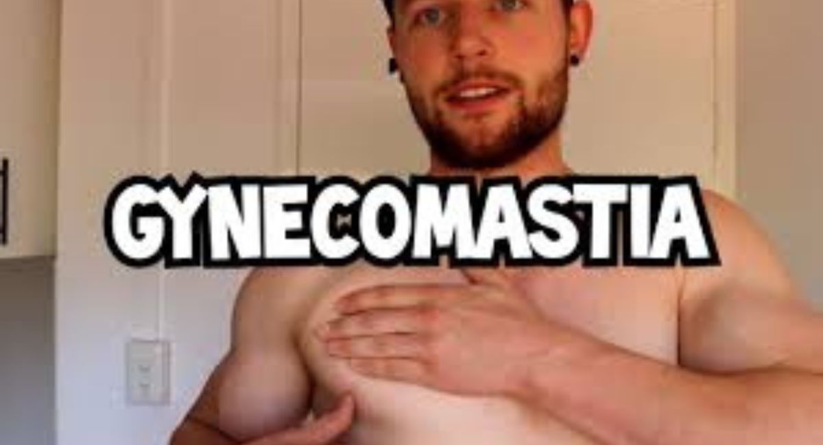 Celebs with Gynecomastia: Shedding Light on a Common Condition